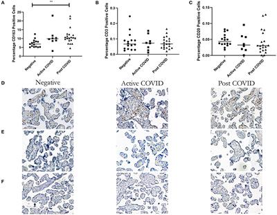 Placental Macrophages Following Maternal SARS-CoV-2 Infection in Relation to Placental Pathology